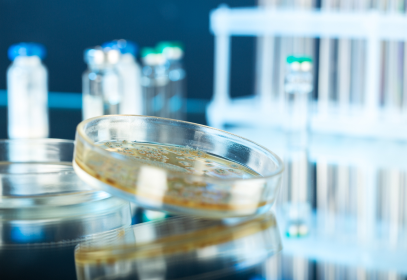 Yellow petri dish on a laboratory table.